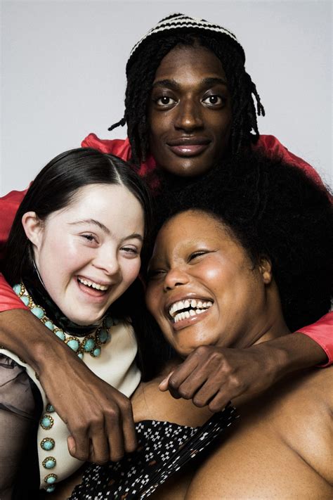 unconventional beauty gucci|Gucci down syndrome.